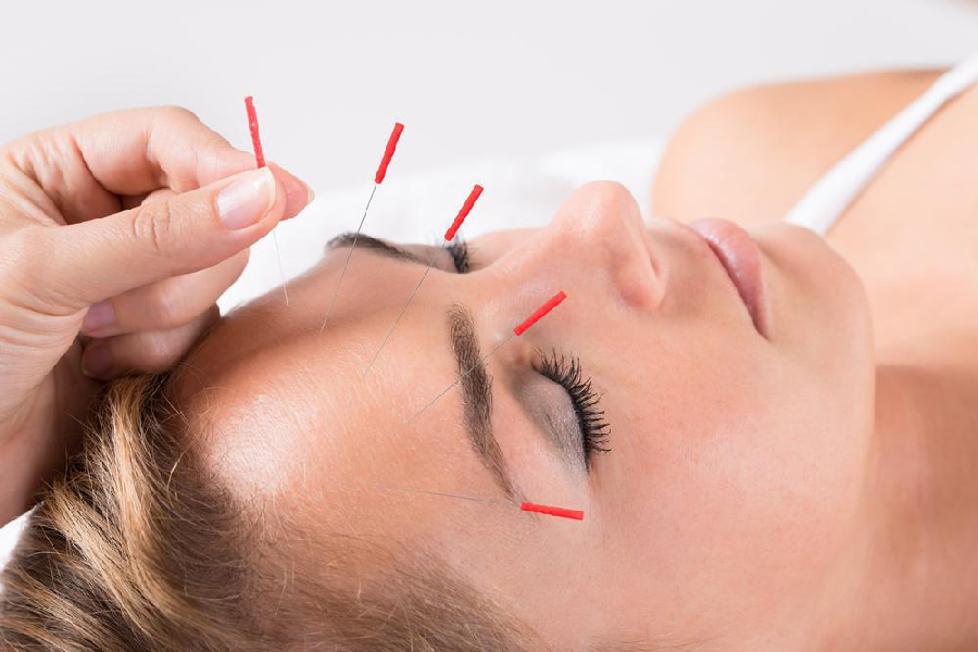 How to treat severe headache?